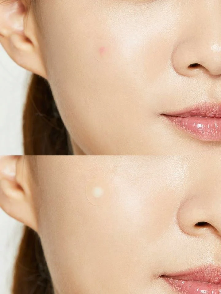 COSRX Acne Pimple Master Patch - Image 2